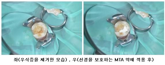 20141007_신도림이스타치과 (1).jpg